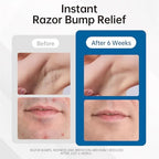 Razor Bumps Ingrown Hair Treatment: 3.38fl.oz Smoothing Solution for Body, Beard & Bikini Area Post Waxing After Shaving Serum for Ingrown Hair & Razor Burn - Women & Men