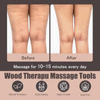 Wooden physical therapy cups, physical therapy massage tools for body shaping lymphatic detoxification, fat reduction, relief of muscle tension and pain, both men and women with wooden massager