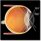 Volk Optical Digital Wide-Field Indirect Ophthalmic Slit Lamp Lens - Blue
