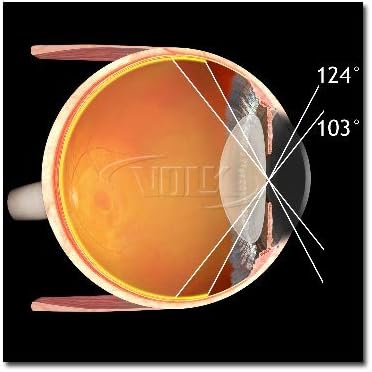 Volk Optical Digital Wide-Field Indirect Ophthalmic Slit Lamp Lens - Blue