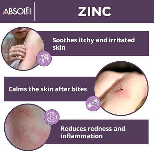 Zinc Oxide Ointment, Natural Ointment for Itching and Rashes with Calendula and Plantain, 1.35 fl oz