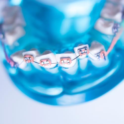 TrelaCo 1 Pack Fake Braces Artificial Tooth Decoration with Metal Wires Metal Bracket and Orthodontic Ligature Ties Practice Props for Dental Students Orthodontist Explain Props(Pink,Without Hook)