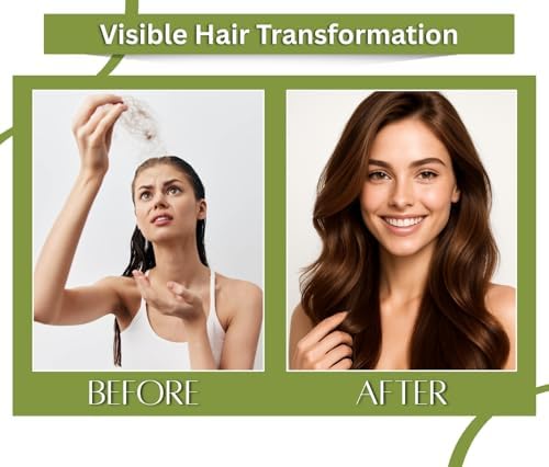 Earth N Pure Brahmi Oil for Hair, Cold Pressed, Natural and Therapeutic Grade with Glass Dropper - 30 ML