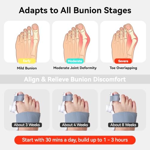 Bunion Corrector for Women & Men Adjustable Big Toe Splint for Hallux Valgus Relief & Toe Alignment, Orthopedic Brace for Pain Relief & Toe Alignment Fits Left & Right Feet 1 PACK