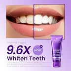 HIMALAYA PINKSALT Purple Whitening Toothpaste - Teeth Whitening, Deep Stain Remover with Fluoride, Plaque Remover, Appropriate for Sensitive Teeth, Peroxide Free - Vanilla Mint, 3.5 oz