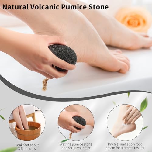 4 PCS Natural Volcanic Pumice Stone for Feet - Rough Feet Scrubber with Hanging Rope for Dead Skin Removal, Pedicure Exfoliation Tool Use for Feet, Elbows, Knees