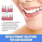 3Pcs Gum Repair Gel, Gum Repair for Receding Gums & Oral Comfort, Gentle Dental Gel for Daily Gum Health, Teeth Whitening Essence Pen, Professional Gum Health Solution