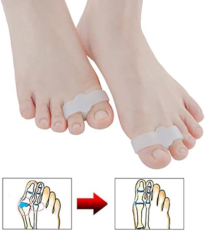 Pair of Thumb Valgus Braces Foot Correction Toe Separator (S)