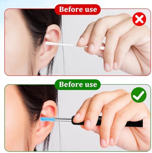 Ear Wax Removal Replacement Tips for Ear Camera 30Pcs Ear Spoon Tips for Wet/Dry Ear Ear Cleaner Tips Wax Cleaning Ear Spoons Tips Silicone Soft Cleaning Reuse Cap for Ear Wax Removal Endoscope