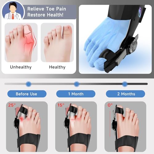 Bunion Corrector for Women & Men - Bunion Fix for Hallux Valgus Pain Relief with Non-Slip Big Toe Separator, Adjustable Big Toe Straighter, Bunion Splints Fits Left & Right Feet (Black 1Pcs)