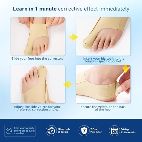 2 Pcs Bunion Corrector & Adjustable Toe Spacer for Women & Men-Big Toe Support with Side & Heel Straps, Hallux Valgus Pain Relief, Comfortable for Day & Night. (2, Beige, M)