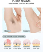 IPL Laser Hair Removal for Women and Men Permanent At-Home Lazer Facial Hair Epilator 999,999 Flashes Painless Hair Remover on Armpits Back Legs Arms Face Bikini Line