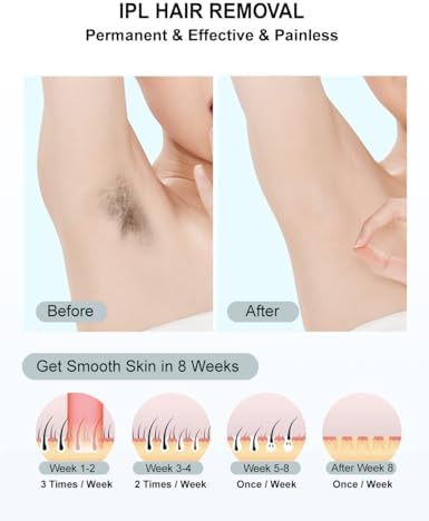 IPL Laser Hair Removal for Women and Men Permanent At-Home Lazer Facial Hair Epilator 999,999 Flashes Painless Hair Remover on Armpits Back Legs Arms Face Bikini Line