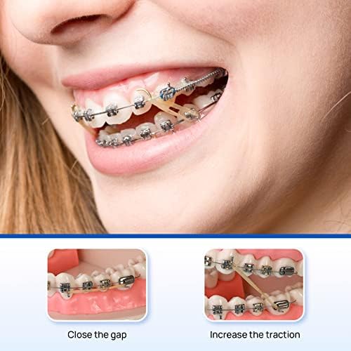 JMU Orthodontic Elastics 3/16 Medium, 100 Pack Orthodontic Rubber Bands Intraoral Elastic Bands Latex Dental Rubber Bands Made in USA