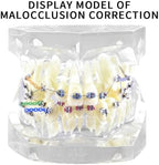 Dental Orthodontic Typodont Teeth Model with Metal Brackets and Ligature Ties for Teaching and Practice