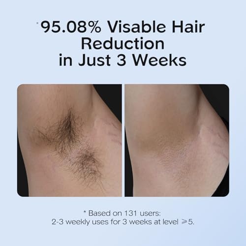 INNZA IPL Hair Removal with Ice Cooling Care Function for Women,Long-Lasting Results,999,999 Flashes Painless Hair Removal, Hair Removal Device for Armpits Legs Arms Bikini Line