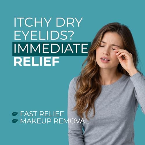 NOVEHA Eyelid & Lash Wipes | For Itchy, Dry Eyes, Styes & Blepharitis | lid and lash Cleansing Wipes, Hypoallergenic & Soothing For Sensitive Eyes, Pack of 60