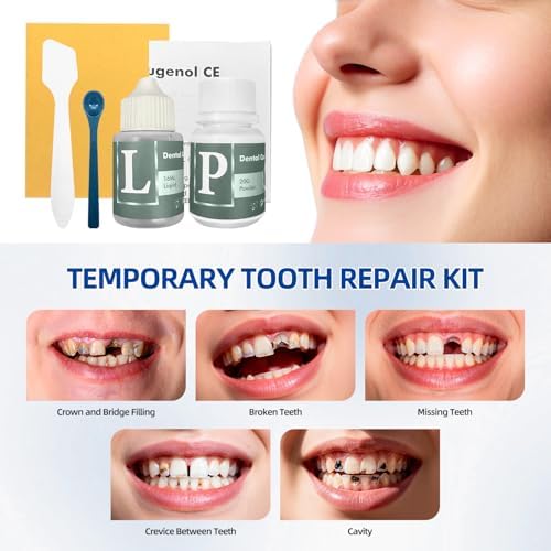 Tooth Repair Kit, Zinc Oxide Eugenol Cement for Cavities Filling, Dental Care Kit for Broken, Chipped or Missing Teeth, Temporary and Permanent Tooth Filling and Crown Fixing at Home