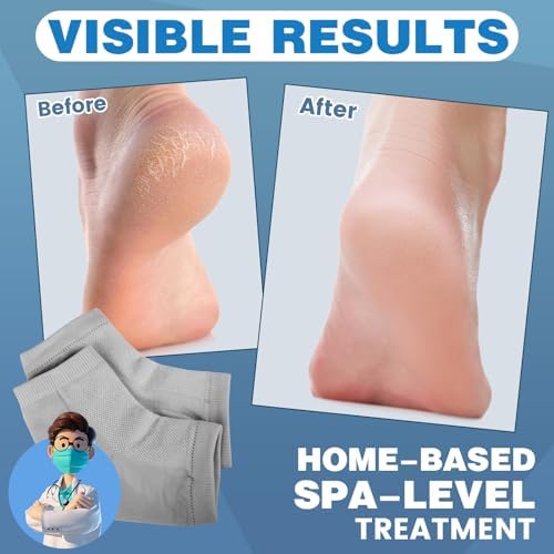 TEAWOO Moisturizing Heel Socks - 6 Pairs for Dry Cracked Feet, Toeless Gel Socks for Hydration and Repair
