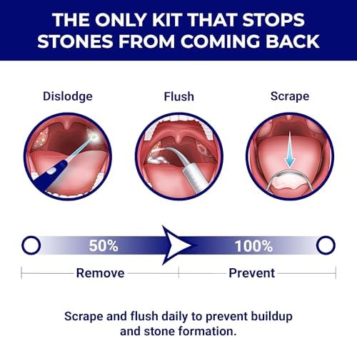ORAVIX Tonsil Stone Remover - Tonsil Stone Removal Kit - Tonsillolith Remover Tool - Tonsil Cleaner - Fight Bad Breath - Tonsil Stone Removal Tool - Oral Irrigator - Tongue Scraper - 7 Pieces