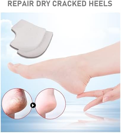 VivoFoot 3 Pairs Gel Heel Protectors, Silicone Heel Socks, Heel Sleeves, Heel Pain and Cracked Heels Relief for Men and Women