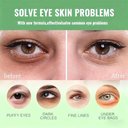 firstfly 60 Pcs Avocado Eye Mask, Under Eye Patches for Dark Circles and Puffiness, Moisturizing Nourishing Eye Treatment Mask, Improving Eye Skin Dryness, Fine Lines and Wrinkles