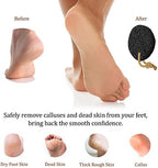 Pumice Stone - Natural Earth Lava Black - Callus/Corn Remover for Feet Heels and Palm - Pedicure Exfoliation Tool - Dry Dead Skin Scrubber - Health Foot Care