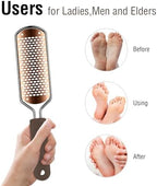 OUKEYA Foot Rasp and Foot File – Premium Stainless Steel Callus Remover Tool for Pedicure, Safely Removes Dead Skin, Smooths Rough Heels, Works on Wet & Dry Feet