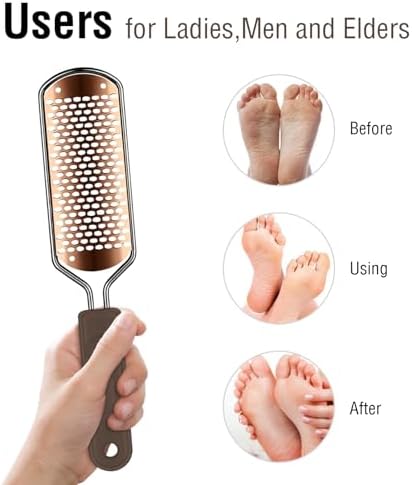OUKEYA Foot Rasp and Foot File – Premium Stainless Steel Callus Remover Tool for Pedicure, Safely Removes Dead Skin, Smooths Rough Heels, Works on Wet & Dry Feet