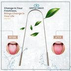 2 Pack Stainless Steel Tongue Scraper with Travel Cases – 304 Metal Tongue Cleaner for Bad Breath, Oral Care Tool for Adults & Teens – Reusable, Rust-Resistant by GENTLE GRACE