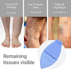 Open Toe Compression Sock Aid for Easy Slide - Slip Stocking Applicator to Help Assist Put On for Elderly, Disabled, Pregnant, 2 Pcs (Blue)