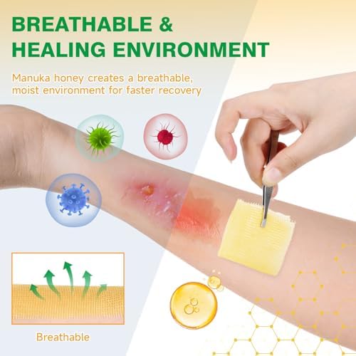 Manuka Honey Gauze Dressing, 4×4 Inches, 12 Individual Pack, Non Stick Gauze Pads, Manuka Honey Wound Care for Wound Healing from Burns, Abrasions, Cuts and Scald, FSA or HSA