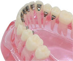 Orthodontic Metal/Ceramic/Invisible Brackets Lingual Brace Teeth Model (M3004: Invisible Metal Bracket Orthodontic Model)