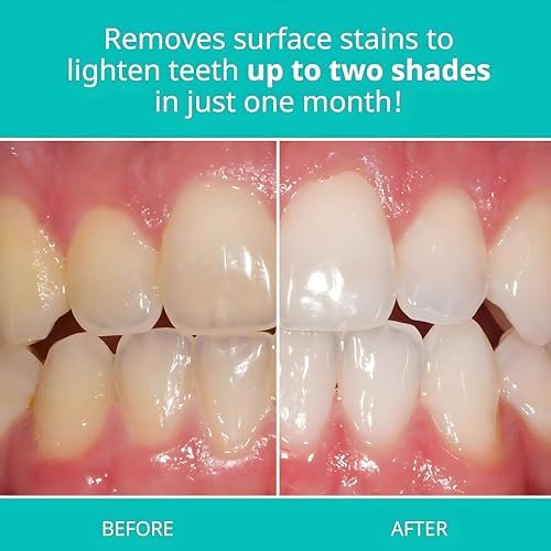 Opalescence Whitening Toothpaste Original Formula (Pack of 3) - Oral Care, Mint Flavor, Gluten Free - 4.7 Ounce - TP-5166-3