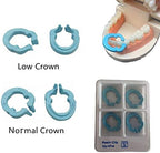 4PCS Dental Resin Clamping Ring Separator Ring Sectional Contoured Metal Matrices Holder Matrix Clips Autoclavable