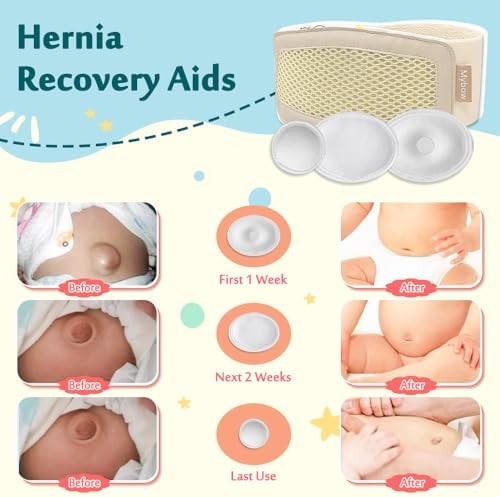 Umbilical Hernia Belt Baby, Infant Belly Button Band, Umbilical Cord Cover for Newborn Abdominal Binder, Hernia Support Truss, Belly Button Shaper, Adjustable Navel Band with 3 Compression Pad