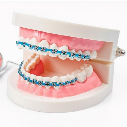 Fake Braces, Temporary Clip on Teeth with Brackets & Wire, Temporary Braces Suitable for Orthodontists to Explain and Practice for Dental Students - Brackets Falsos Para Dientes(Light Blue)