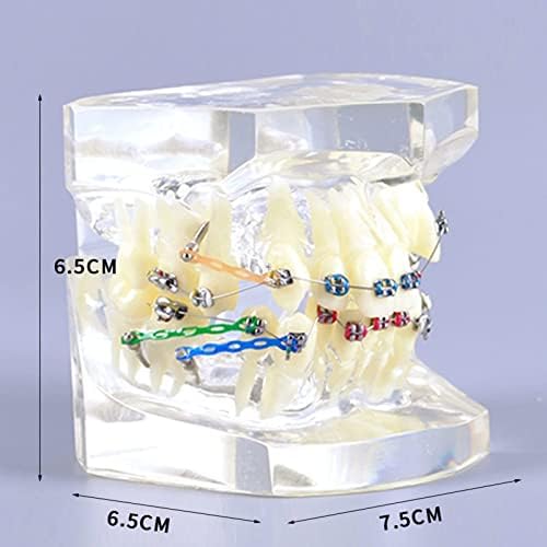 Dental Orthodontic Typodont Teeth Model with Metal Brackets and Ligature Ties for Teaching and Practice
