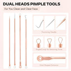 FEITA Blackhead Remover Pimple Comedone Extractor Tool, Stainless Acne Tools Pimple Popper Removal Kit, Zit Whitehead Popping Needle for Nose & Face, Rose Gold 4Pcs