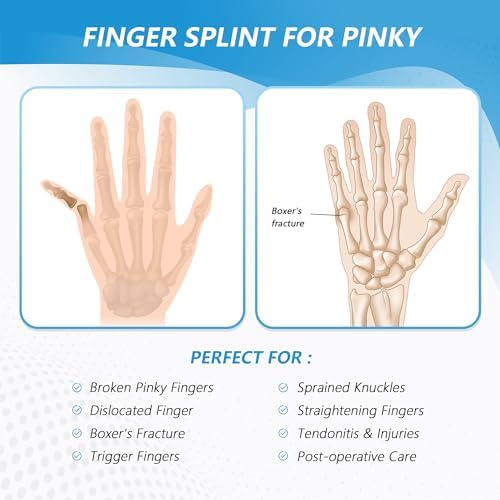 Pinky Finger Splint, Finger Splint for Pinky, Broken Finger, Trigger Finger, Metacarpal Splint Hand Brace, Little Finger Brace for Tendonnitis, Pain Relief, Fits for Left & Right Hand(L)