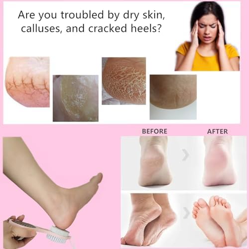 Foot Scrubber Brush with Pumice Stone for Feet, 5-in-1 Foot File Callus Remover, Stainless Steel Feet Scraper, Cleaning Brush and Sand Paper Debris Catcher, Multi Purpose for Home Foot Care
