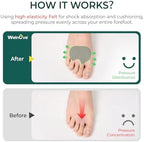 Ball-of-Foot Cushions Pads for Women Men - Welnove 6 Pairs Felt Metatarsal Pads for Dancer Forefoot Support - Soft Foot Pad for Metatarsalgia, Morton’s Neuroma, Calluses, Fit for High Heels,Shoes