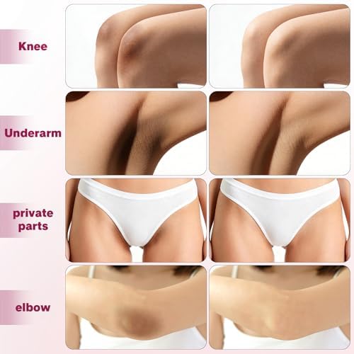 Skin Bleaching Cream Skin Lightening For Intimate Areas Private Parts, Underarm, Inner Thigh, Bikini Area, Knees And Elbows,Intimate Underarm Dark Spot Corrector Whitening Cream