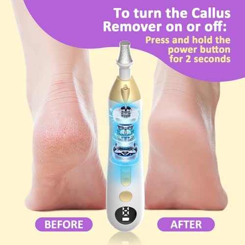 Mfish Electric Callus Remover for Feet, Rechargeable Foot File with Digital Display, 9 Speeds & 8 Grinding Heads, Professional Pedicure Tool for Thick Calluses, Cracked Heels & Hard Skin White