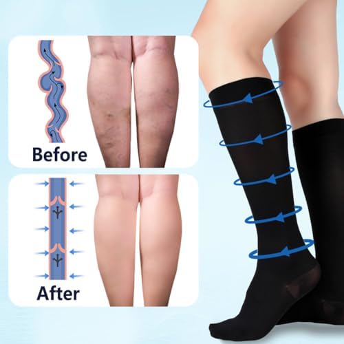 +MD 15-20 mmHg Medical Compression Socks for Men/Women, Lightweight Opaque Knee High Support Stockings