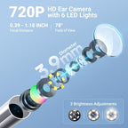 ScopeAround Otoscope with Light, 1.45" IPS Display Digital Otoscope, 3.9mm Ear Camera with Ear Wax Removal Tools, Ear Scope with Extention Cable, 6 LED Lights, Capture Photos Videos, White