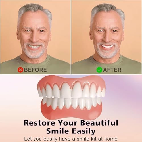 Silicone Reline Denture Set for Upper and Lower Teeth, Soft Comfortable Veneers for Women (1 Count (Pack of 1))-YC02