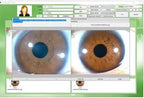 5.0 MP USB Iridology Camera Analyzer, Iris Analysis Camera, High Resolution Ccd USB Iriscope Eye Iridology Camera, HD 30x Iris Lens Analysis English Pro Iris Software