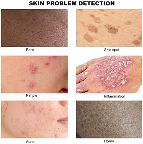 50X/200X Skin Diagnosis Hair Analyzer, 7 Inch Screen Digital Skin Diagnosis Scanner System Hair Analyzer Analysis Scanner Skin Health Detection