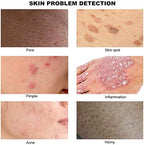 50X/200X Skin Diagnosis Hair Analyzer, 7 Inch Screen Digital Skin Diagnosis Scanner System Hair Analyzer Analysis Scanner Skin Health Detection